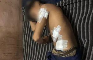 Class 8 student stabbed by classmate in Gujarat’s Mahisagar