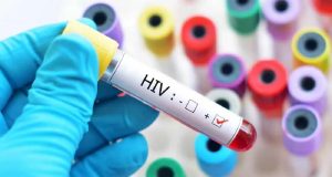 Chandigarh में HIV मामलों में बढ़ोतरी, अभी तक 35 लोगों की जा चुकी है जान